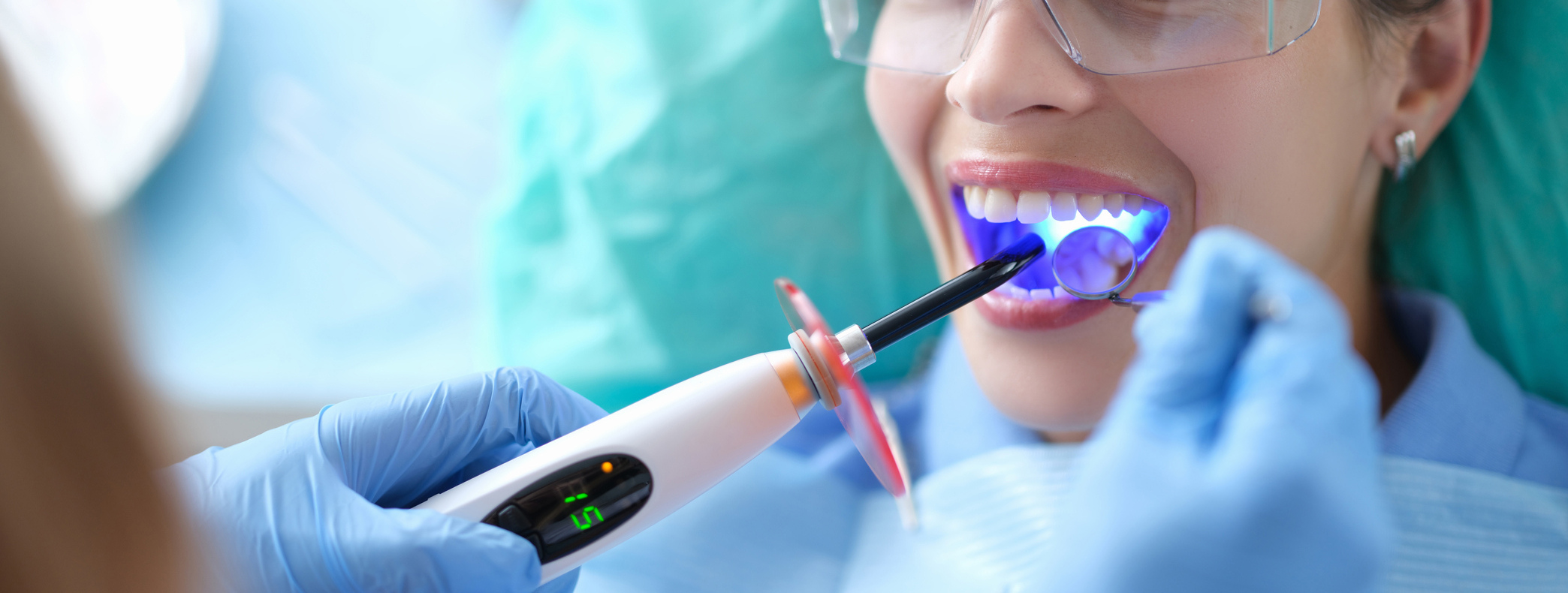 Composite Bonding