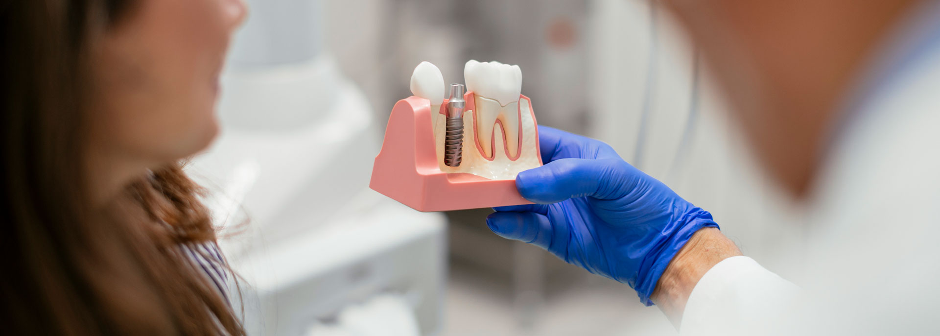 Dental Implant