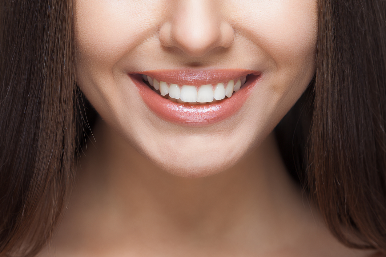 Teeth whitening