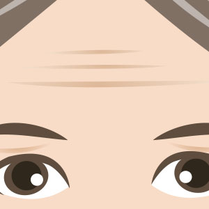 Forehead lines