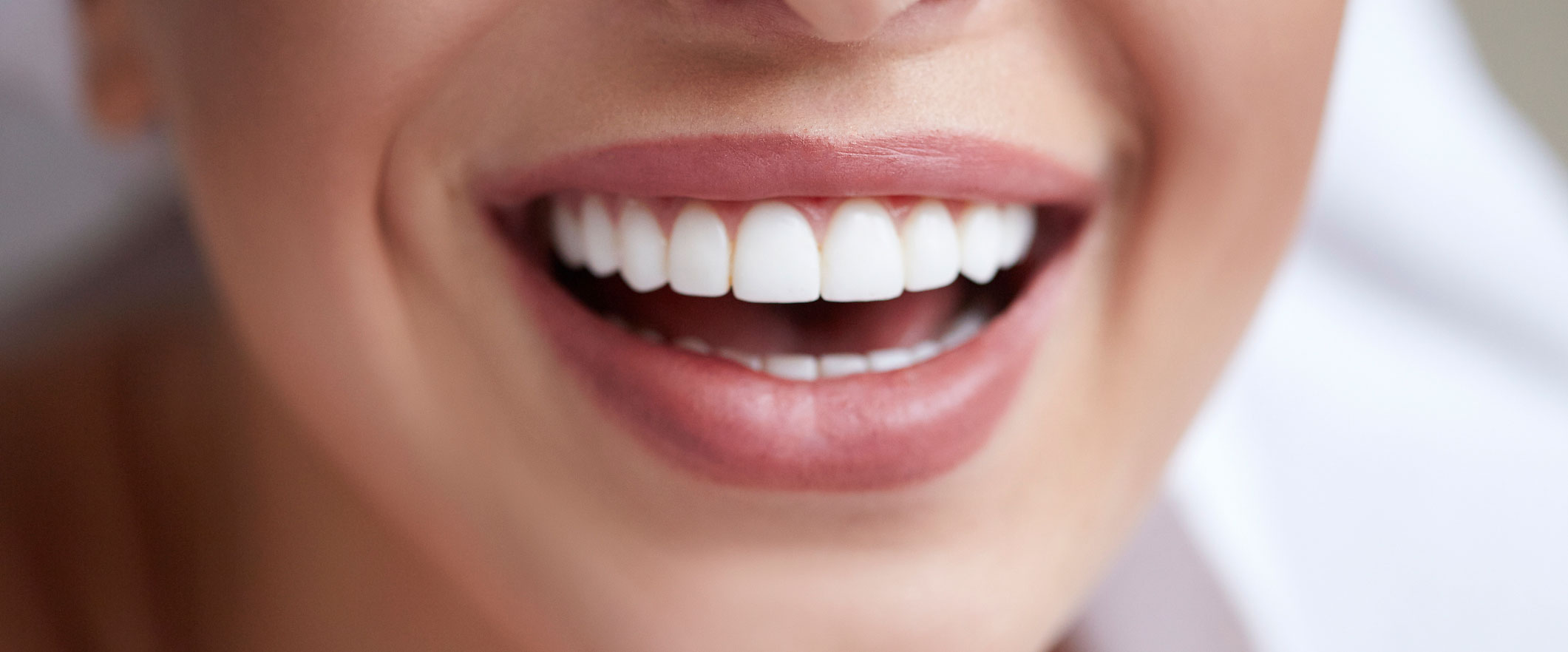 White smile close up
