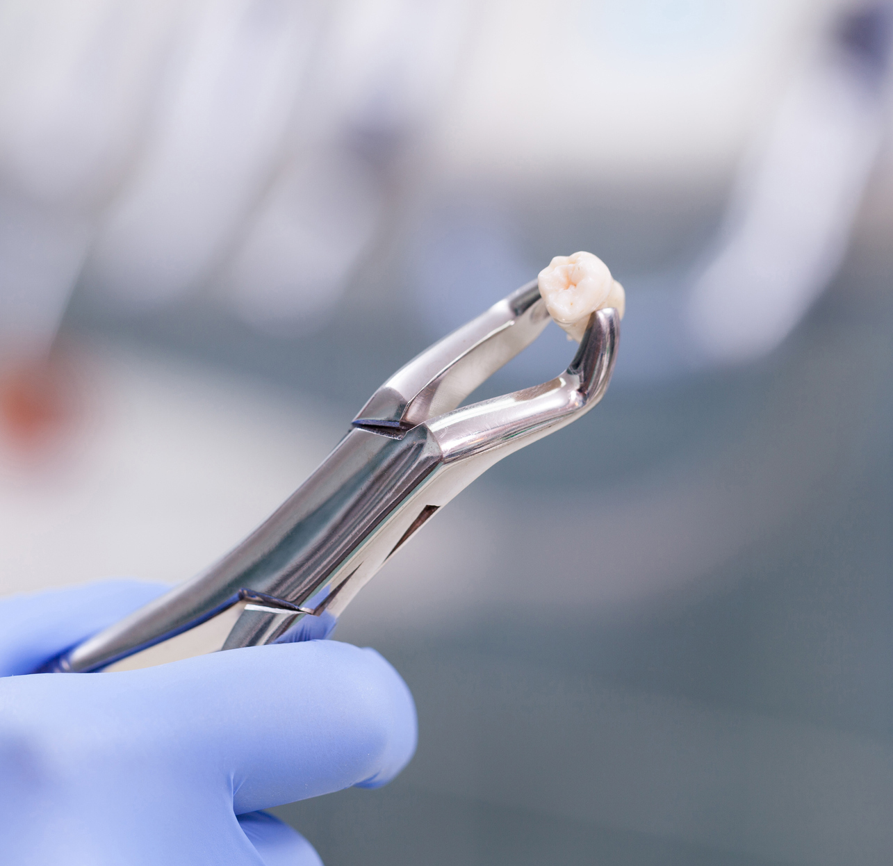 Dental extraction