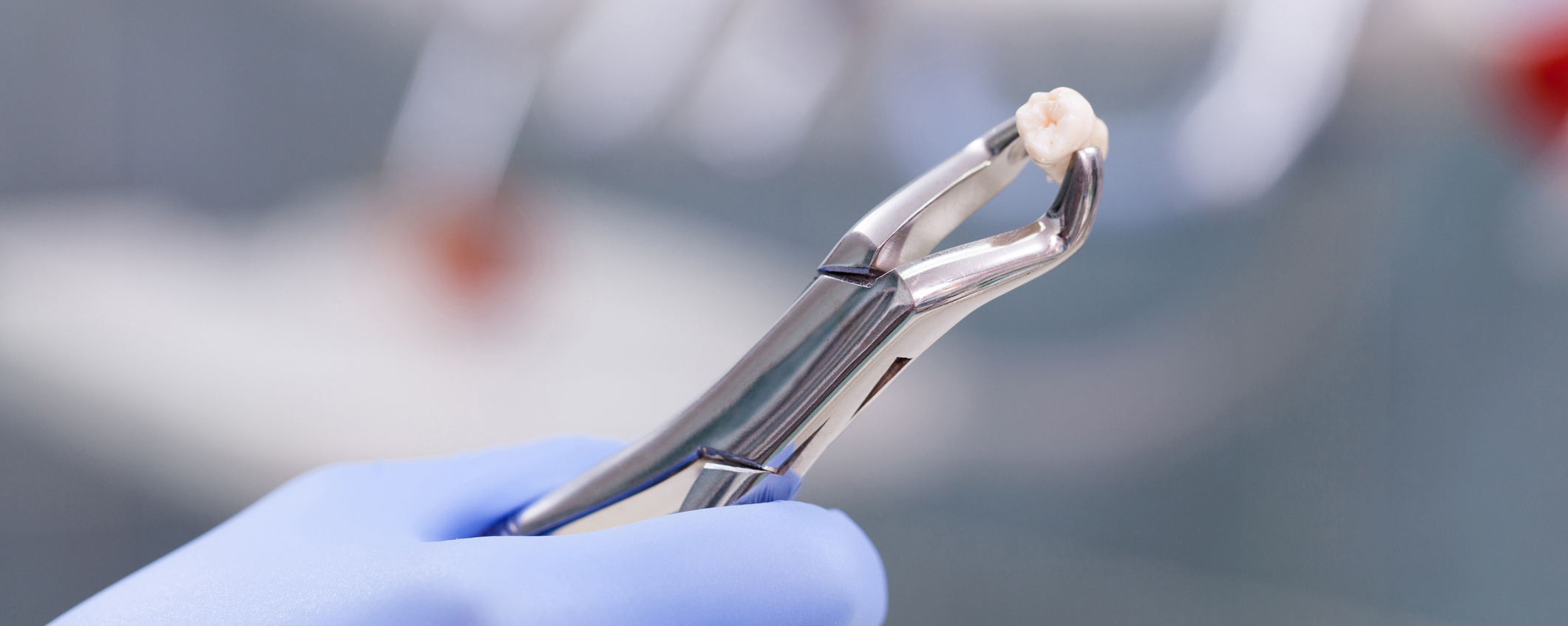 Tooth extraction