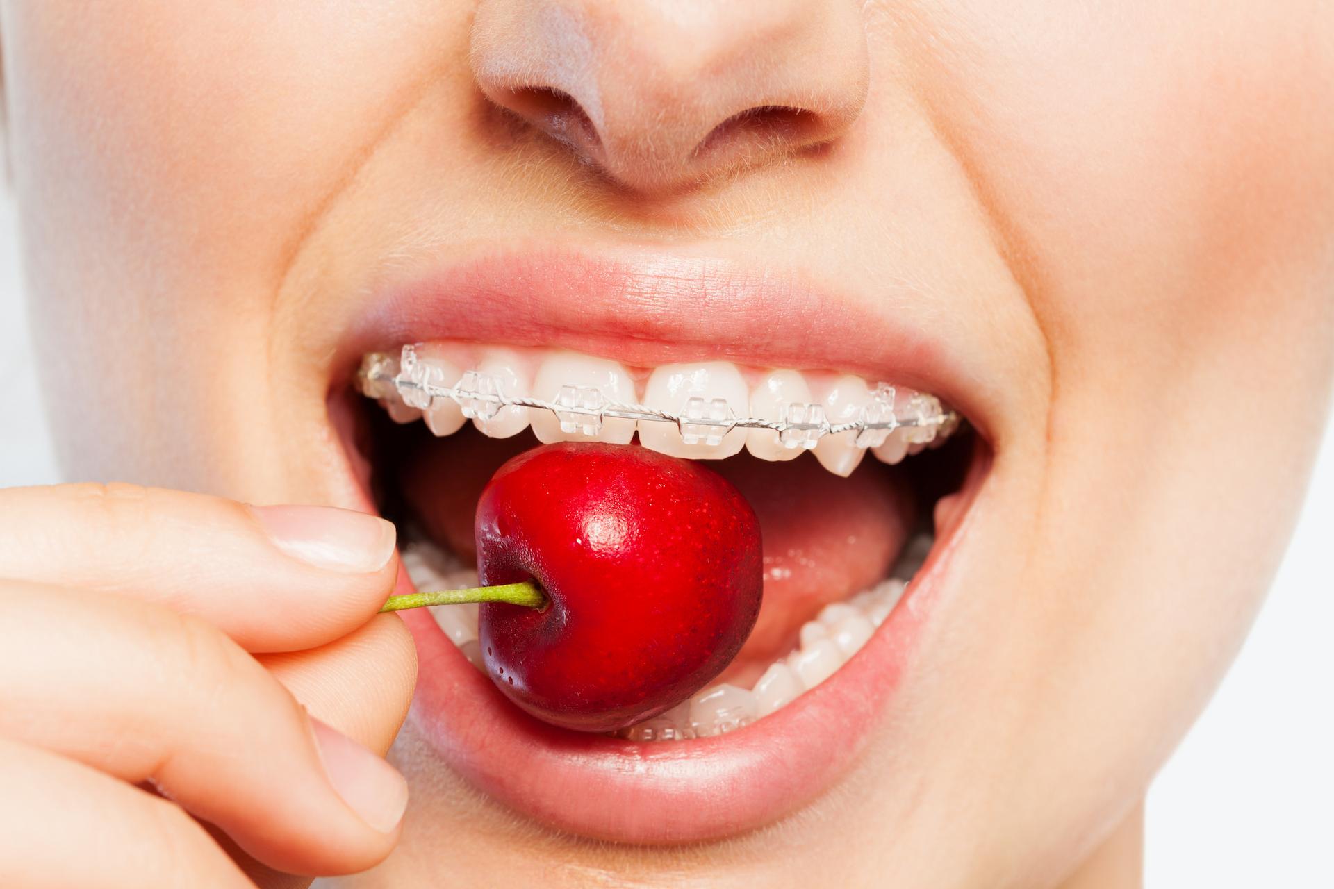 Eating with clear brace